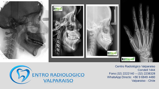 Centro Radiológico Dental Valparaiso