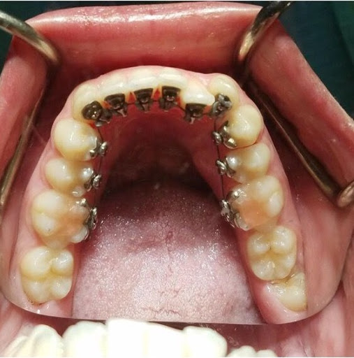 Upland Dental Implant and Orthodontics