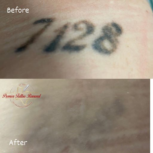 Explore bruno mars tattoo ideas, creative tattoo ideas in Mckinney, available at Premier Tattoo Removal