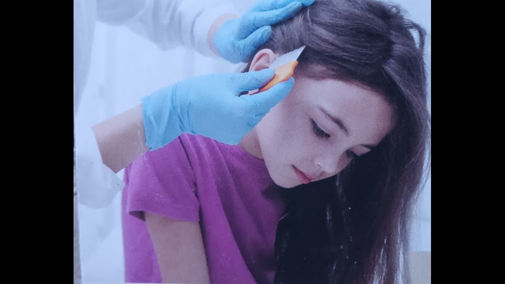 Sans Poux Freelice 07604