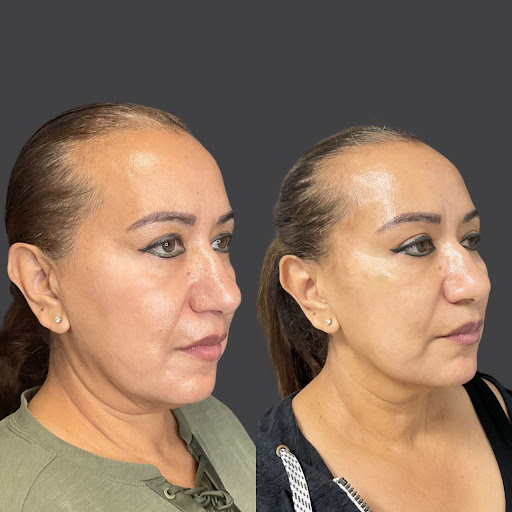 Explore silly tattoo ideas, creative tattoo ideas in Whittier, available at Skin Perfect Medical Aesthetics