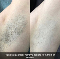 LaserAway By Rita - Photo 4 - Car repair in Sterling Heights, MI, Sterling Heights