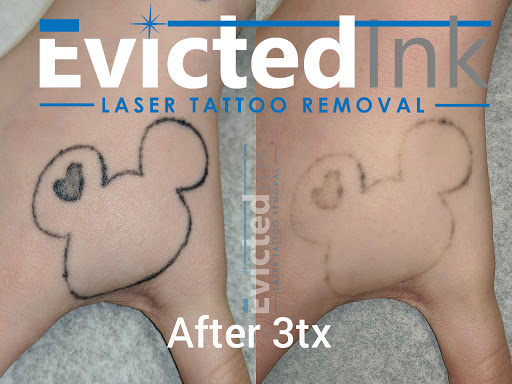 Explore psychedelic tattoo ideas, creative tattoo ideas in Wichita, available at Evicted Ink Laser Tattoo Removal