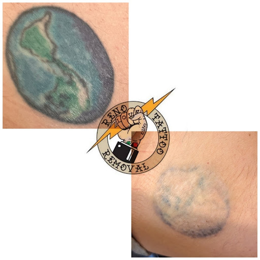 Explore apache tattoo ideas, creative tattoo ideas in Reno, available at Reno Tattoo Removal