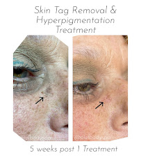 Piel Body Spa - Photo 8 - Car repair in Charlotte, NC, Charlotte