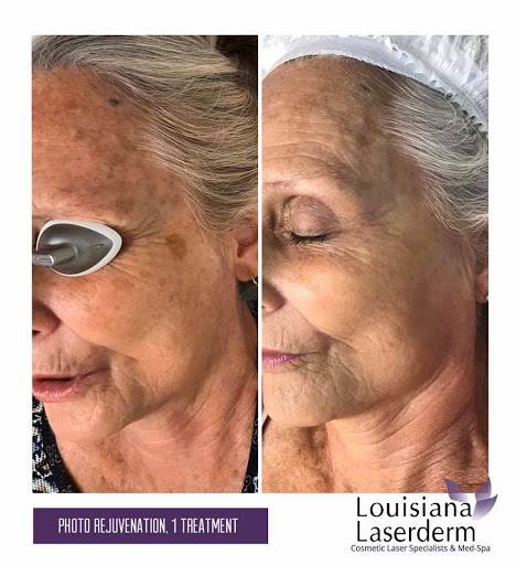 Explore family tattoo ideas small, creative tattoo ideas in Baton Rouge, available at Louisiana Laserderm