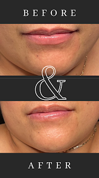 True Skin Luxury - Photo 1 - Car repair in Concord, CA, Concord