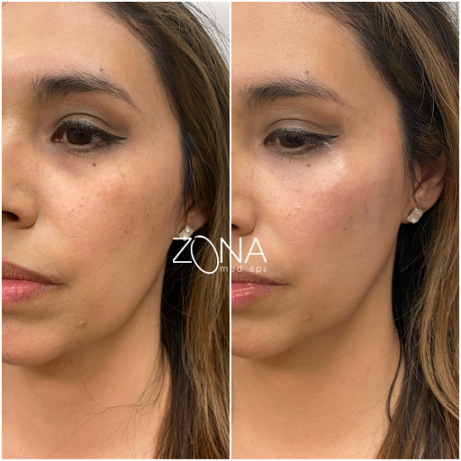 Skin Care Clinic «ZONA MED SPA», reviews and photos, 9767 N 91st St #102, Scottsdale, AZ 85258, USA