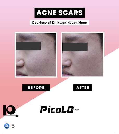 Explore cactus tattoo ideas, creative tattoo ideas in Lake Dallas, available at Restore YOUth Med Spa