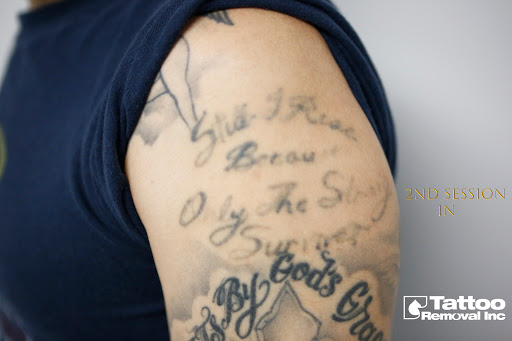 Explore jojo bizarre adventure tattoo ideas, creative tattoo ideas in South Gate, available at Tattoo Removal Inc