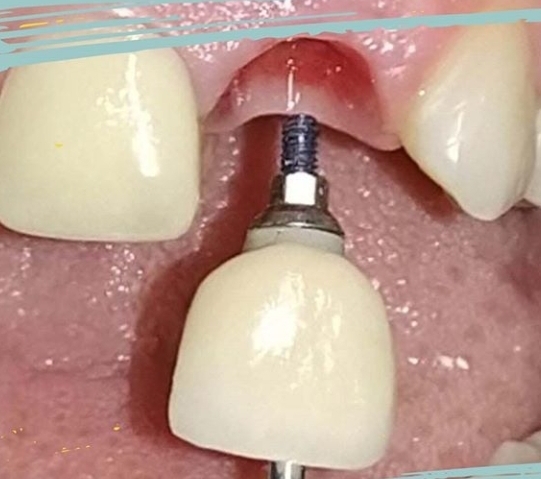 Clínica Odontológica Lacoste & Montaña - Dentista
