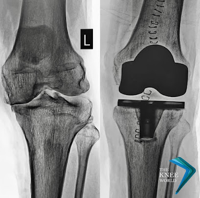 The Knee Klinik-Wanowrie - The Knee Klinik-Wanowrie