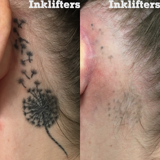 Explore calf tattoo ideas for men, creative tattoo ideas in Pleasant Grove, available at Inklifters Tattoo Removal