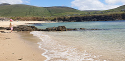 Φωτογραφία του Clogher Beach περιτριγυρισμένο από βουνά
