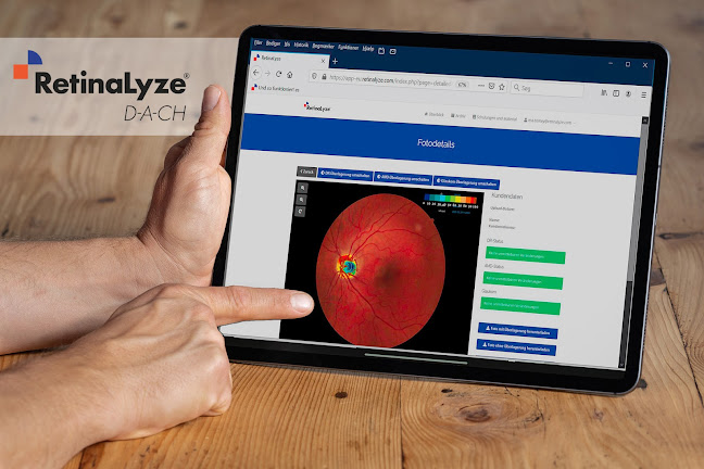 Augenscreening RetinaLyze System (Switzerland) GmbH - Webdesigner