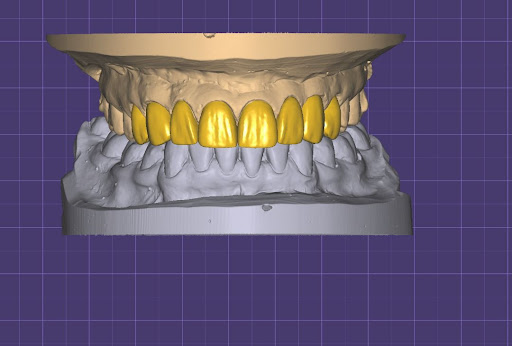 Dental implantology courses Melbourne
