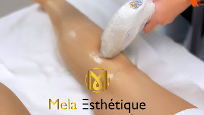 Mela Esthetique à Avignon