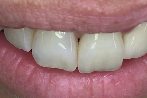Aesthetic dental Kozina image