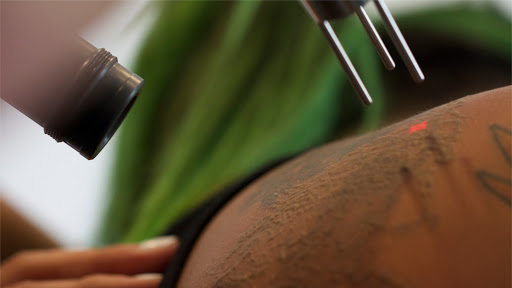 Explore british tattoo ideas, creative tattoo ideas in San Diego, available at Evolve Tattoo Removal