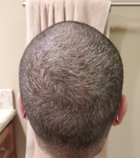 Explore cross tattoo sleeve ideas, creative tattoo ideas in Minneapolis, available at Medical Tattoo & Cosmetic Centers of America