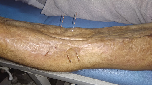 PhysioPort Delhi Physiotherapy Services - PhysioPort Delhi Physiotherapy Services