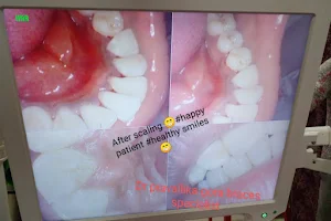 Heidi's Dental Care-yendada |best orthodontist madhurawada | dental clinic vizag image