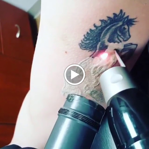 Explore tattoo ideas for back of shoulder, creative tattoo ideas in Vienna, available at Removery Tattoo Removal & Fading