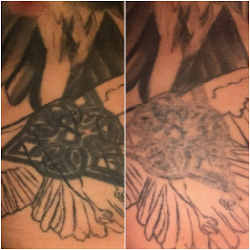 Explore tattoo hip ideas, creative tattoo ideas in Houston, available at Htown Lasers