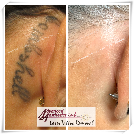 Find top shoulder tattoo ideas for your next unique tattoo in South Dartmouth at Advanced Aesthetics Ink Laser Tattoo Removal