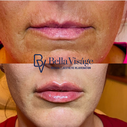 Explore silverback gorilla tattoo ideas, creative tattoo ideas in Lakeland, available at Bella Visge Medical & Aesthetic Rejuvenation