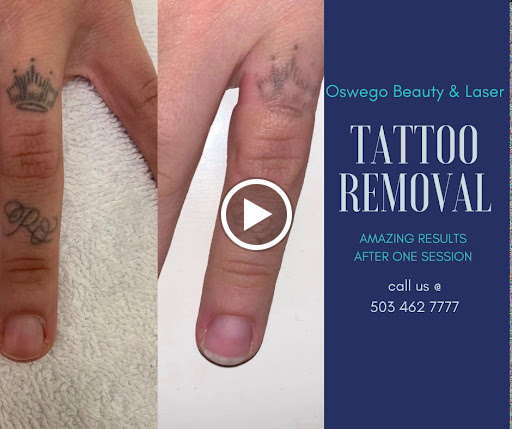 Explore rip cross tattoo ideas, creative tattoo ideas in Lake Oswego, available at Oswego Beauty and Laser