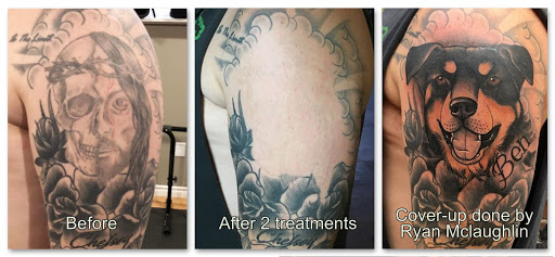 Explore tattoo ideas for elbow, creative tattoo ideas in Honolulu, available at Removery Tattoo Removal & Fading