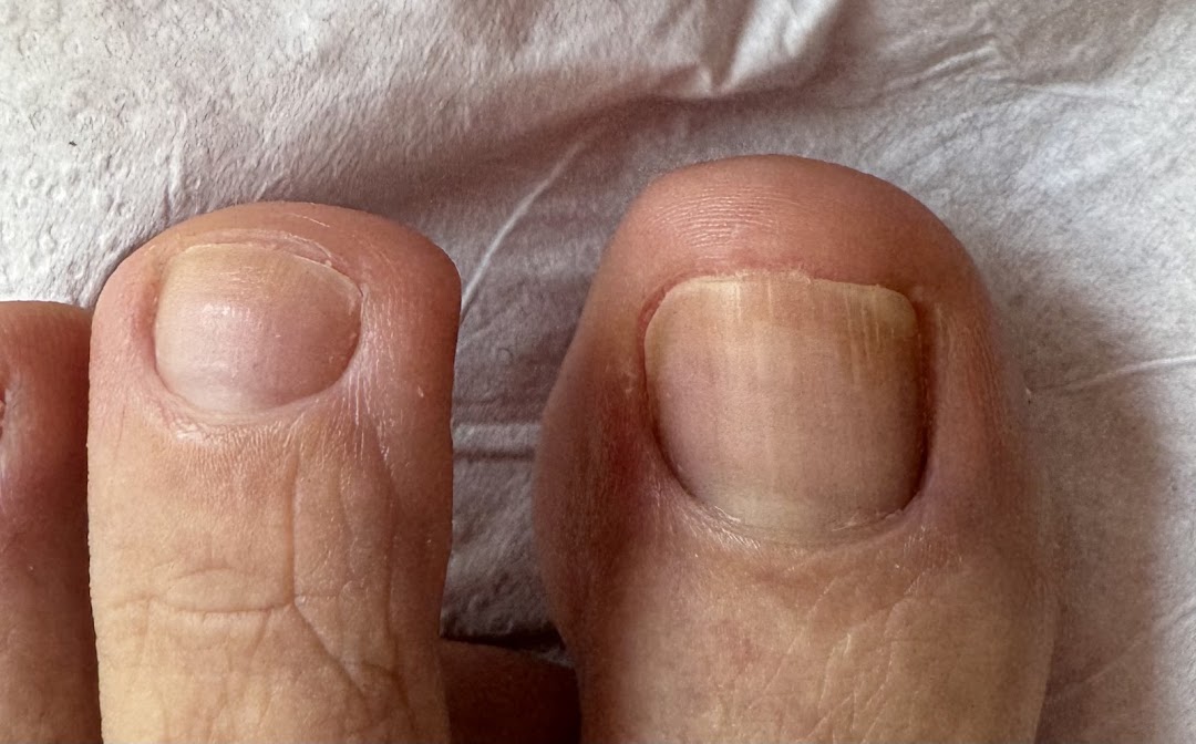 Podolife Ayak Sağlığı Merkezi ( Podoloji )