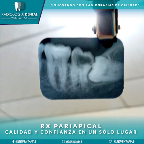 Radiología Dental Ventanas - Ventanas