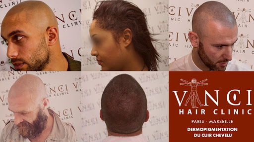 Vinci Hair Clinic Paris