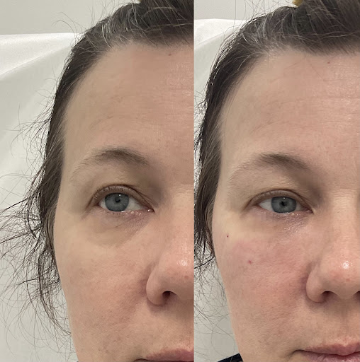 Explore stillbirth tattoo ideas, creative tattoo ideas in Owensboro, available at The Skin Lab