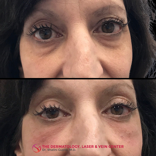 Explore aquarius tattoo ideas for men, creative tattoo ideas in Cincinnati, available at The Dermatology, Laser & Vein Center