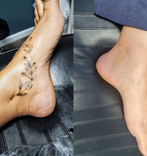 Explore pinup tattoo ideas, creative tattoo ideas in Rochester, available at Rochester Tattoo Removal