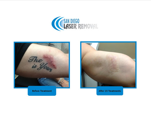 Explore flower half sleeve tattoo ideas, creative tattoo ideas in San Diego, available at Removery Tattoo Removal & Fading