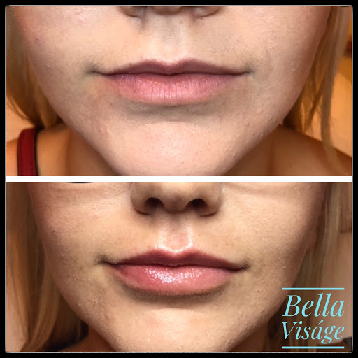 Explore virgin mary tattoo ideas, creative tattoo ideas in Lakeland, available at Bella Visge Medical & Aesthetic Rejuvenation