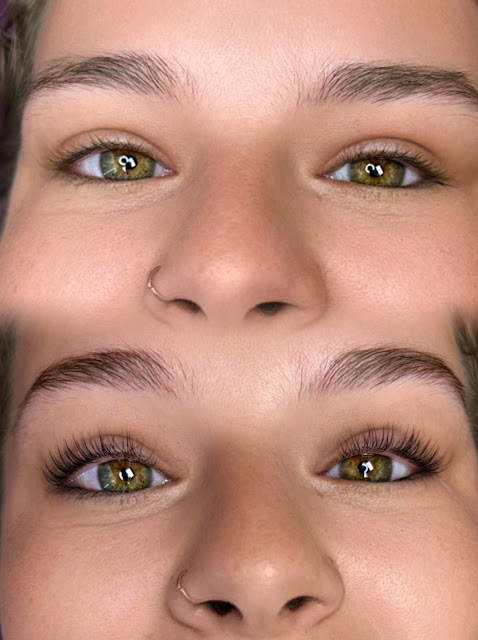 Mountain Dragonfly Esthetics