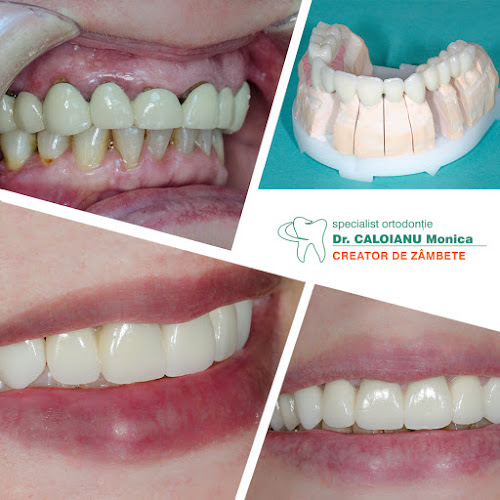 Cabinet Stomatologic Dr. Caloianu Monica, Specialist Ortodont - Dentist