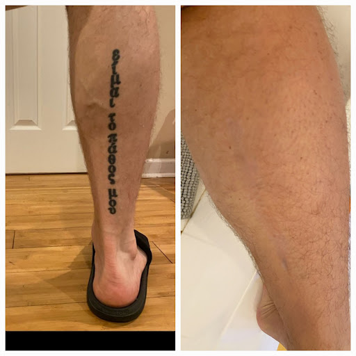Explore full body tattoo ideas, creative tattoo ideas in Cumming, available at Atlanta Tattoo Removal