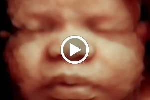 Baby Joy 3D 4D Mobile Ultrasound image
