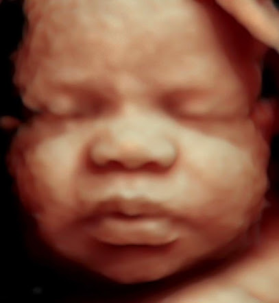 Baby Joy 3D 4D Mobile Ultrasound