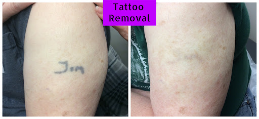 Explore first tattoo ideas men's, creative tattoo ideas in Lake Oswego, available at Lake Oswego Vein and Aesthetic LOVA