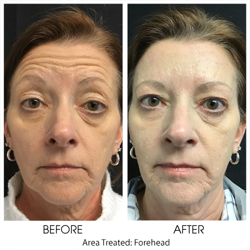 Explore great white shark tattoo ideas, creative tattoo ideas in York, available at Lbo Aesthetics & Spa - York, PA