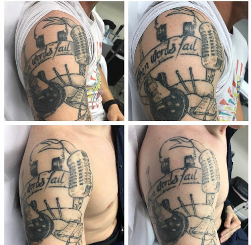 Explore hellraiser tattoo ideas, creative tattoo ideas in Allen, available at Shipers Laser Tattoo Removal Center Dallas