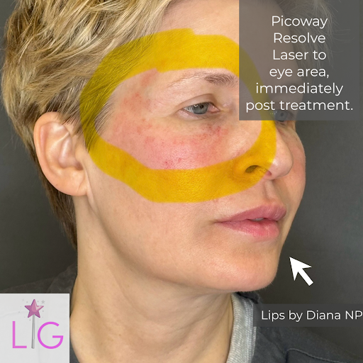 Explore dolphin tattoo ideas, creative tattoo ideas in Bayside, available at Laser Goddess