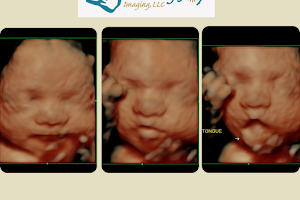 Growing Joy Imaging | 3D/4D Ultrasound Facility image
